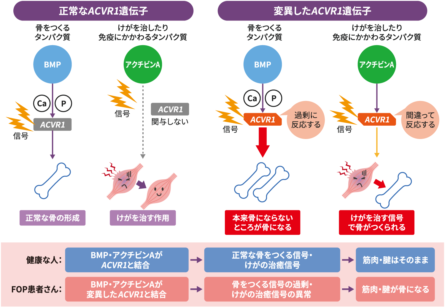 正常なACVR1遺伝子と、変異したACVR1遺伝子の仕組みを比較した模式図。